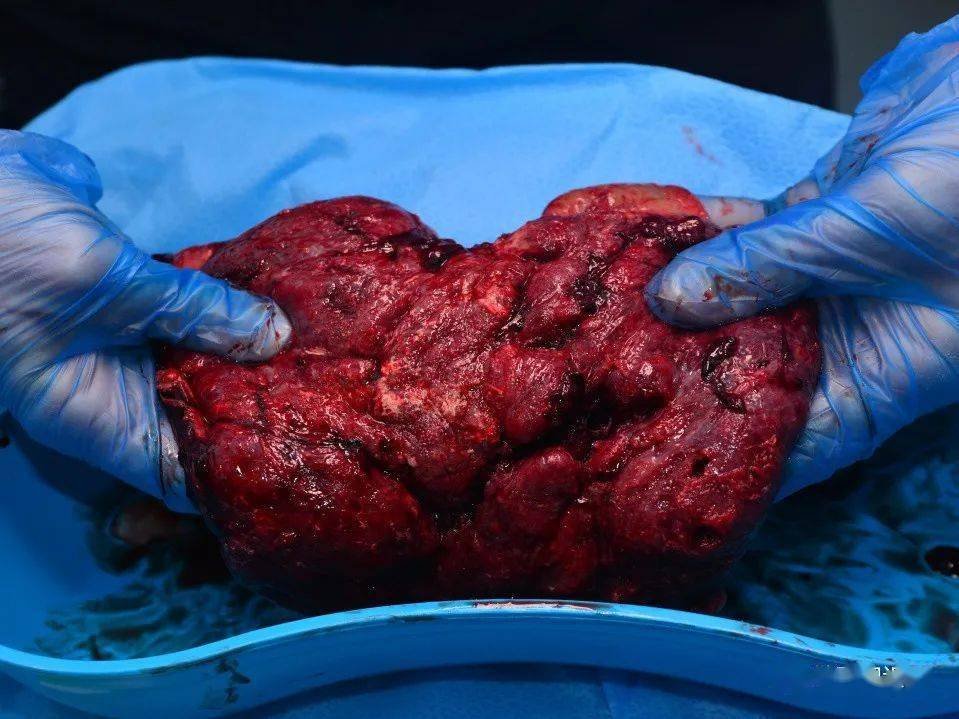 格鲁吉亚代孕的社会影响_印度代孕工厂_阿肯夏代孕诊所